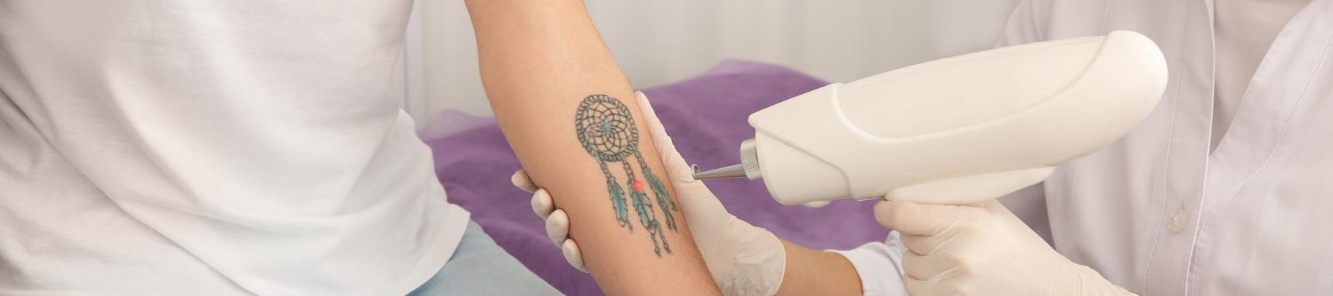 Eliminación de tatuajes y micropigmentación en Oro Puro Belleza, Ciudad Real